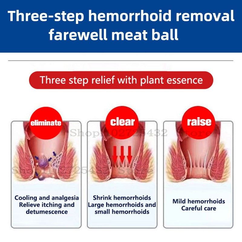 Hemorroidide vastane kreem FastRelief™